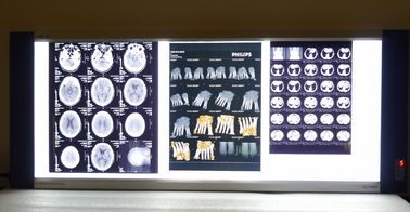 Fuji/Agfa 엑스레이 영화, 8in x 10in 의학 건조한 Termal 인쇄 기계 영화